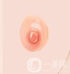 乳暈縮小整形手術(shù)價(jià)格是多少呢?