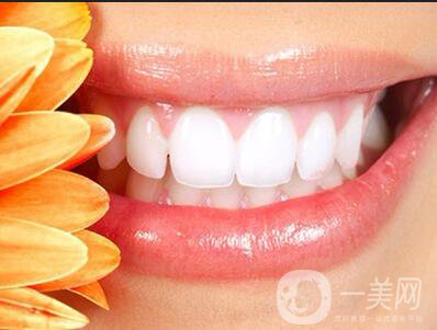 貴金屬烤瓷牙,全瓷牙