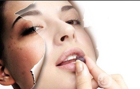 激光祛斑價(jià)格