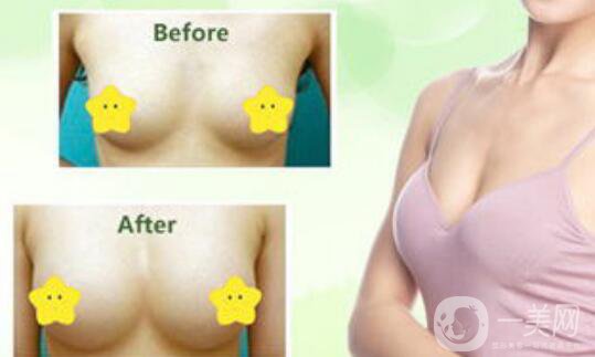 隆胸修復(fù),隆胸修復(fù)價(jià)格