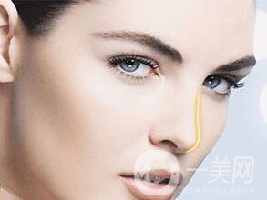 假體隆鼻多少錢(qián)