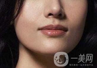 鷹鉤鼻矯正注意事項