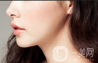 光子嫩膚,光子嫩膚調(diào)節(jié)黃褐斑,光子嫩膚調(diào)節(jié)黃褐斑優(yōu)缺點