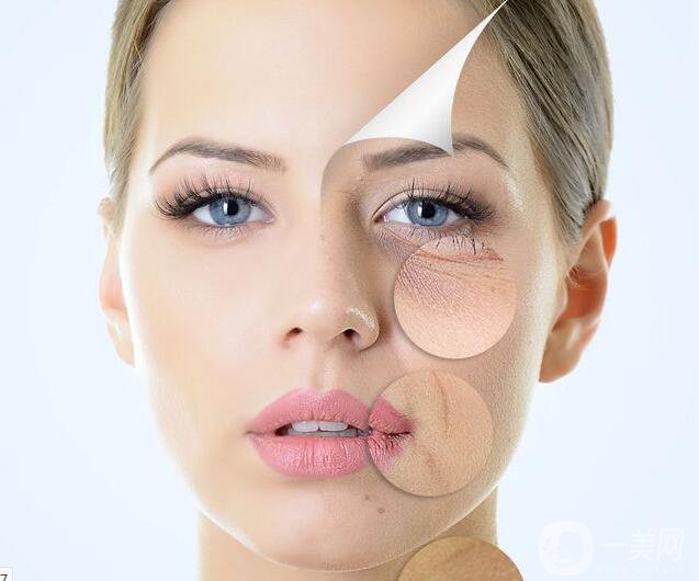 射頻和電波拉皮那個好