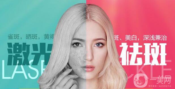 激光祛斑的價(jià)格是多少