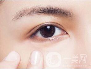 雙眼皮修復(fù)