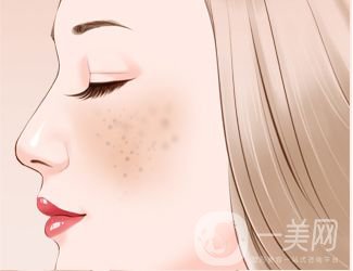 長(zhǎng)了黃褐斑怎么辦 光子嫩膚調(diào)節(jié)黃褐斑價(jià)格