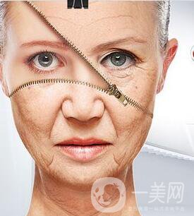 皮膚松弛與褶皺 射頻和電波拉皮信息介紹？