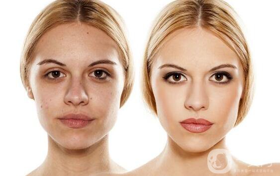 光子嫩膚是什么 價格多少？