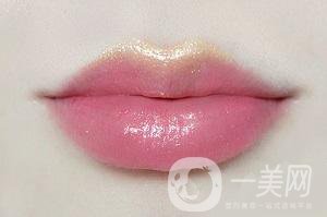 什么樣的人適合豐唇 豐唇方法有哪些