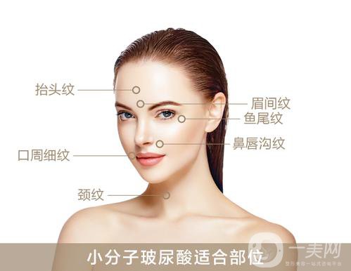 上海瑞蘭玻尿酸價格？*果怎么樣？