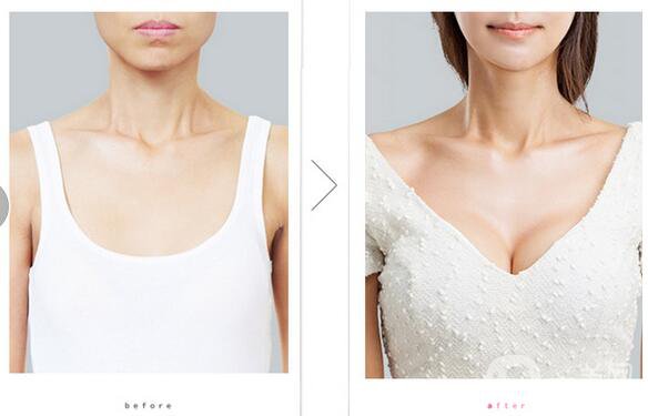 自體脂肪填充注意事項