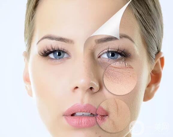 拉皮手術(shù)多少錢(qián)一次？