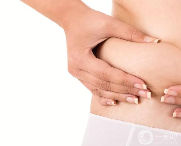 去妊娠紋價(jià)格是多少？