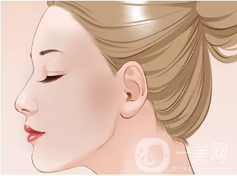 硅膠豐太陽穴貴嗎 硅膠豐太陽穴價格