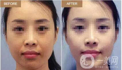 冬天應(yīng)該怎么護(hù)膚99%的人壓根就不知道，但這篇教你！