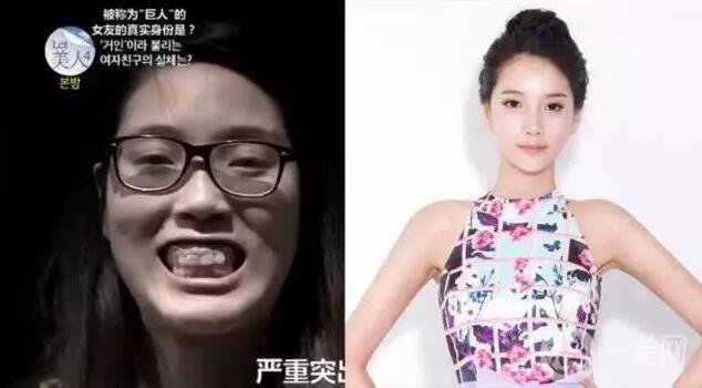 整容對人生的改變真的大嗎 整容后的人生變好了嗎