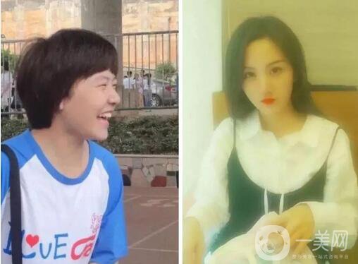 整容對人生的改變真的大嗎 整容后的人生變好了嗎