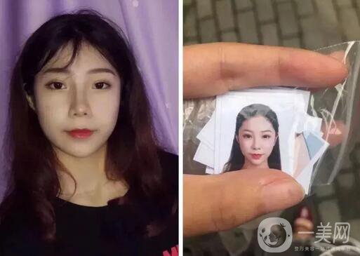 整容對人生的改變真的大嗎 整容后的人生變好了嗎