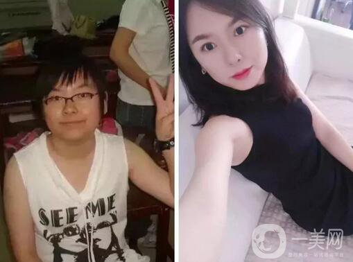 整容對人生的改變真的大嗎 整容后的人生變好了嗎