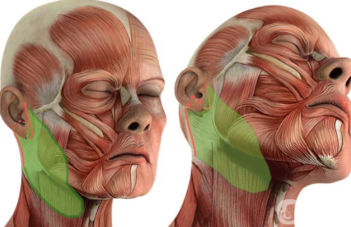 頸部松弛怎么辦 微創(chuàng)頸年輕化手術(shù)-聚四氟乙烯(PTFE)除皺術(shù)
