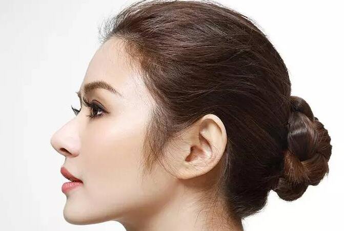 隆鼻手多少錢(qián),隆鼻貴不貴