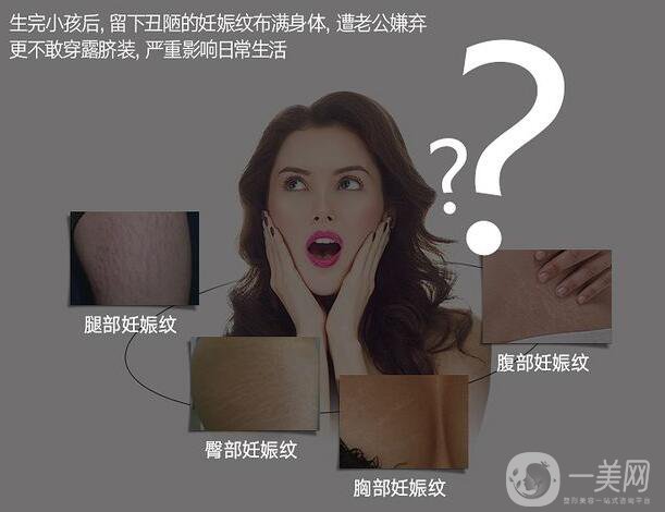 去妊娠紋價錢是多少？