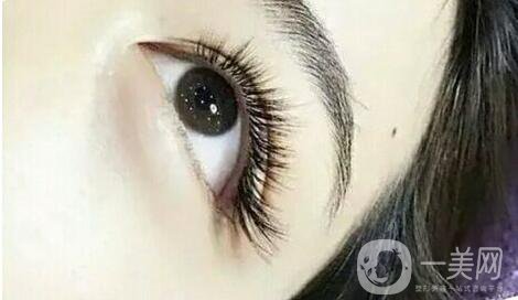 嫁接睫毛修復(fù)價(jià)格 嫁接睫毛的*果怎么樣