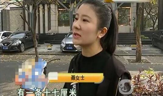 驚！女子花5萬整形，大腿留下17厘米疤痕