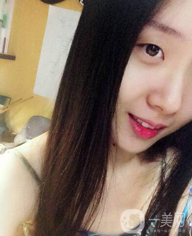 整容到底為了什么？知乎回答扎進心窩