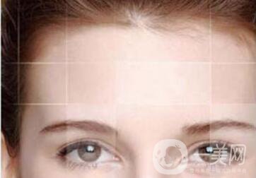 膨體豐額頭, 膨體豐額頭價(jià)格