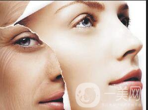 拉皮手術(shù)多久恢復(fù),拉皮手術(shù)注意事項(xiàng)