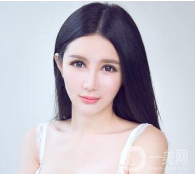 駝峰鼻影響美貌 駝峰鼻矯正術(shù)的價(jià)格是多少？