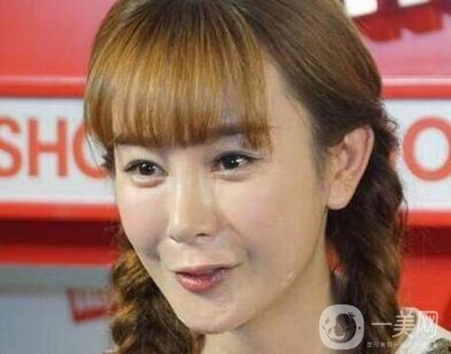 明星整容就是不承認？ 然后突然臉“爛”了！