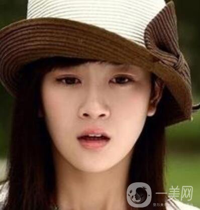 明星整容就是不承認？ 然后突然臉“爛”了！