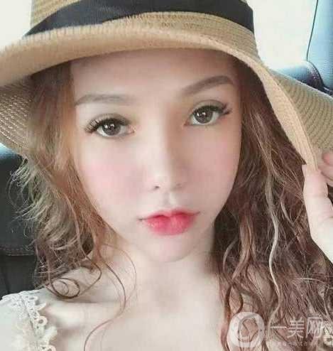 女子被前男友嫌丑 怒花12萬整容成美女