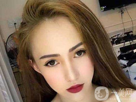 女子被前男友嫌丑 怒花12萬整容成美女