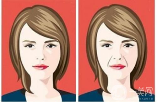 玻尿酸去法令紋價(jià)格多少 玻尿酸去法令紋的*果