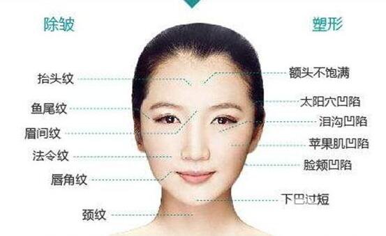 自體脂肪面部填充幾天恢復(fù) 自體脂肪面部填充*果