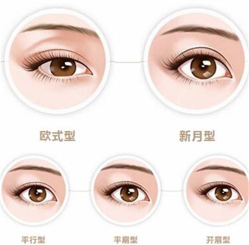 冬季割雙眼皮注意什么？術(shù)后吃什么好？