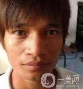 小伙整容數(shù)十次，只為一張韓星臉