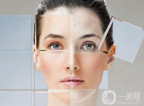 去法令紋多少錢 去法令紋的手術方法