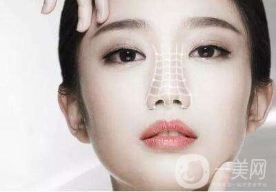 硅橡膠隆鼻要多少錢  硅橡膠隆鼻材料