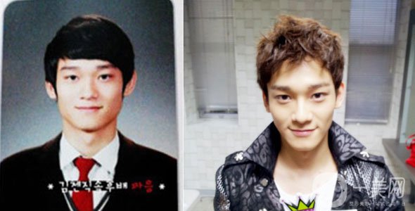 韓國3位進(jìn)行雙頜手術(shù)的明星 前后*果