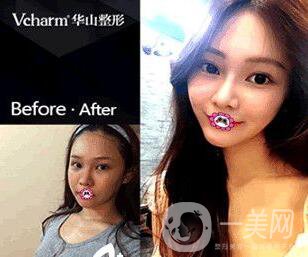 鄭州*整形醫(yī)院