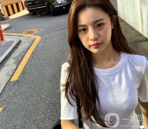 做完整容手術后你能有多開心？