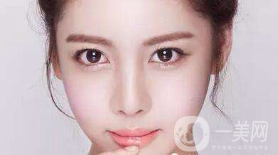 廣東上海假體豐眉弓費用是多少