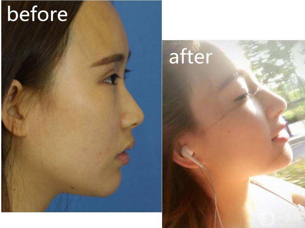 金瀚回應(yīng)丑帥男星，沒有整容的朱一龍也上榜了