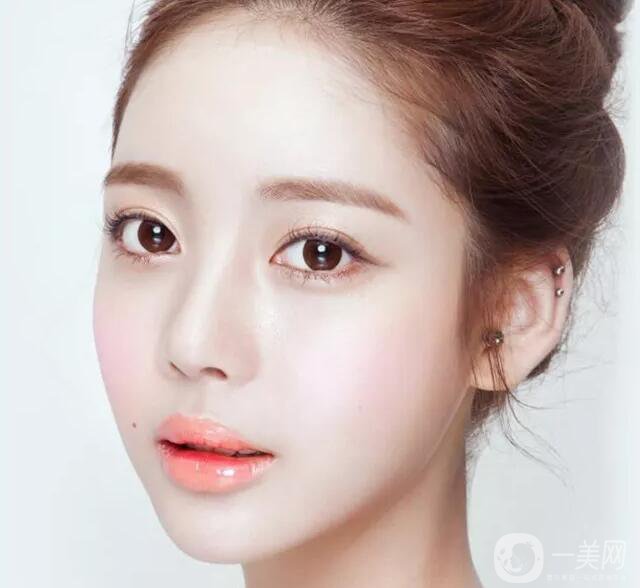 韓式開眼角手術(shù)*果怎么樣？