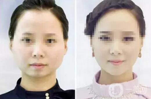 **果好嗎？*前后圖